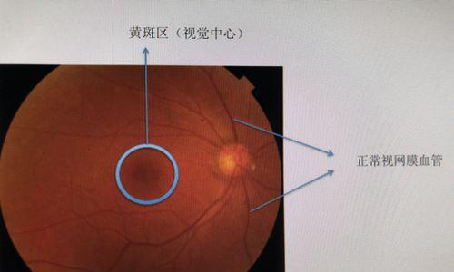 玩游戏也能过视网膜成像！